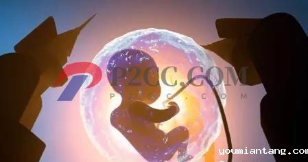 同样时间怀孕，为什么有的显怀而有的不显怀？或与胎儿健康有关？(图2)