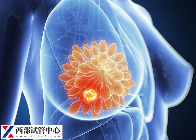 远离乳腺癌,从了解开始(图1) 33.jpeg