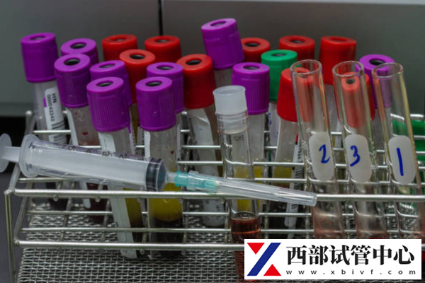 试管婴儿怎么节省费用?掌握5个关键点,开启省钱之旅!(图2) 试管婴儿费用如何节省